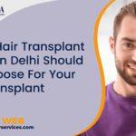 Which Hair Transplant Doctor In Delhi Should You Choose For Your Hair Transplant Surgery