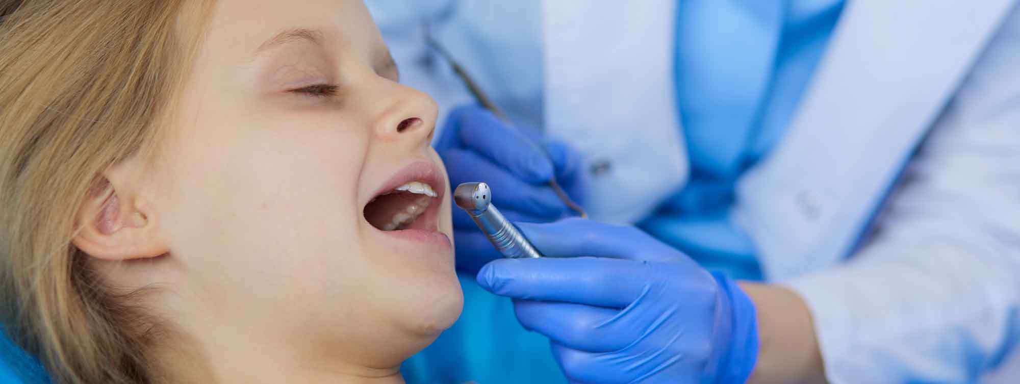 Factors Influencing the Cost of Wisdom Tooth Removal in Houston