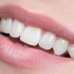 Emergency Treatment in Broxburn: Swift Dental Care When You Need It