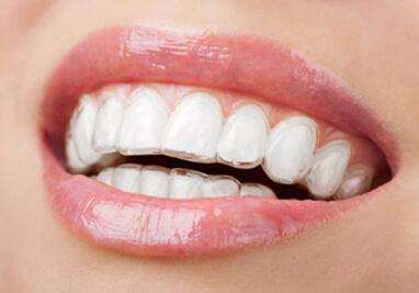 Invisible Teeth Aligners in Barrow: A Clear Path to a Confident Smile