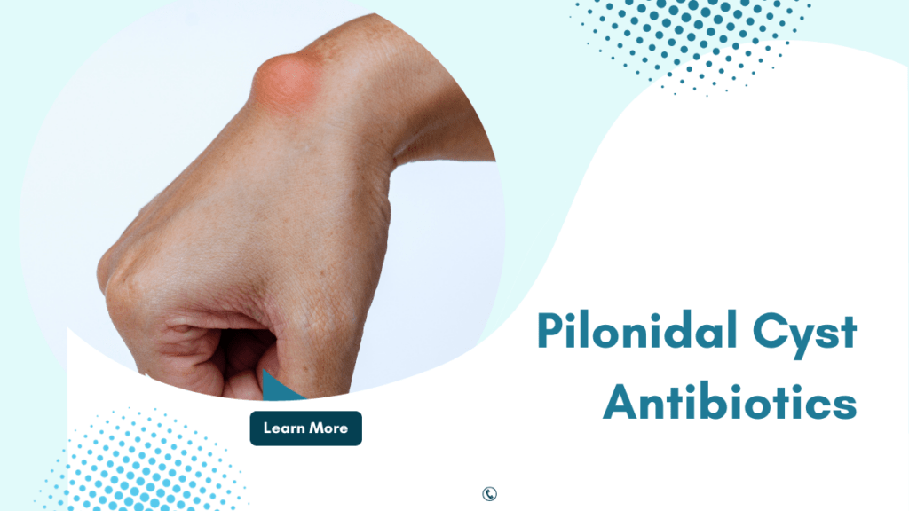 Effectiveness of Antibiotics in Pilonidal Cyst Treatment