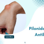 Effectiveness of Antibiotics in Pilonidal Cyst Treatment