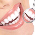 10 Ways Orthodontic Spacers Transform Your Teeth