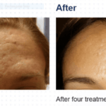 How Voluma Can Enhance Your Natural Beauty