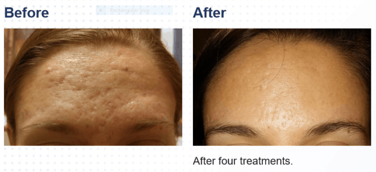 How Voluma Can Enhance Your Natural Beauty