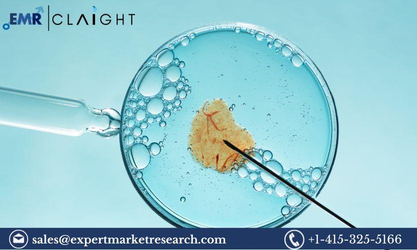 Cryopreservation for In-Vitro Fertilization (IVF) Market Size, Share, Price, Trends, Growth, Analysis, Report and Forecast 2024-2032 