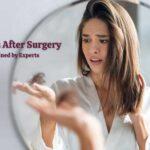 Hair Loss After Surgery Explained by Experts