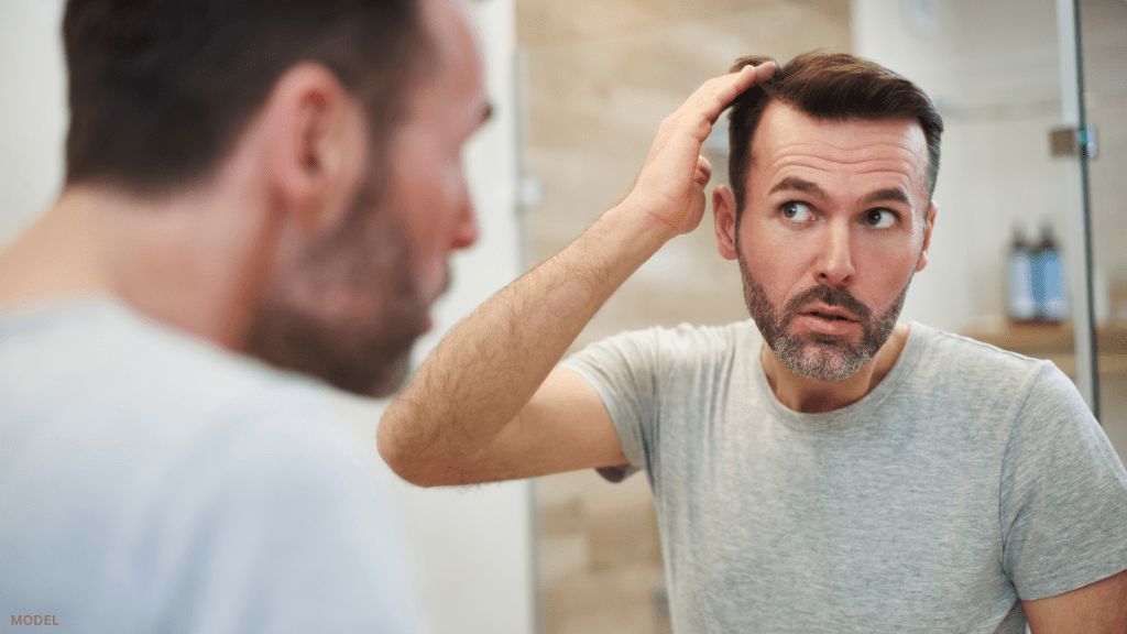 The Ultimate Guide to Hair Transplants in Ft. Lauderdale: SmartGraft Restoration