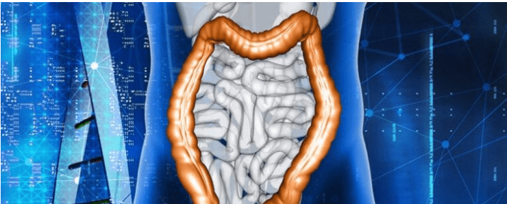 Strategies to Avoid Gastrointestinal Diseases