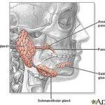 Navigating Tumor Surgеry – 4 Simplе Guidеlinеs for a Smooth Journеy