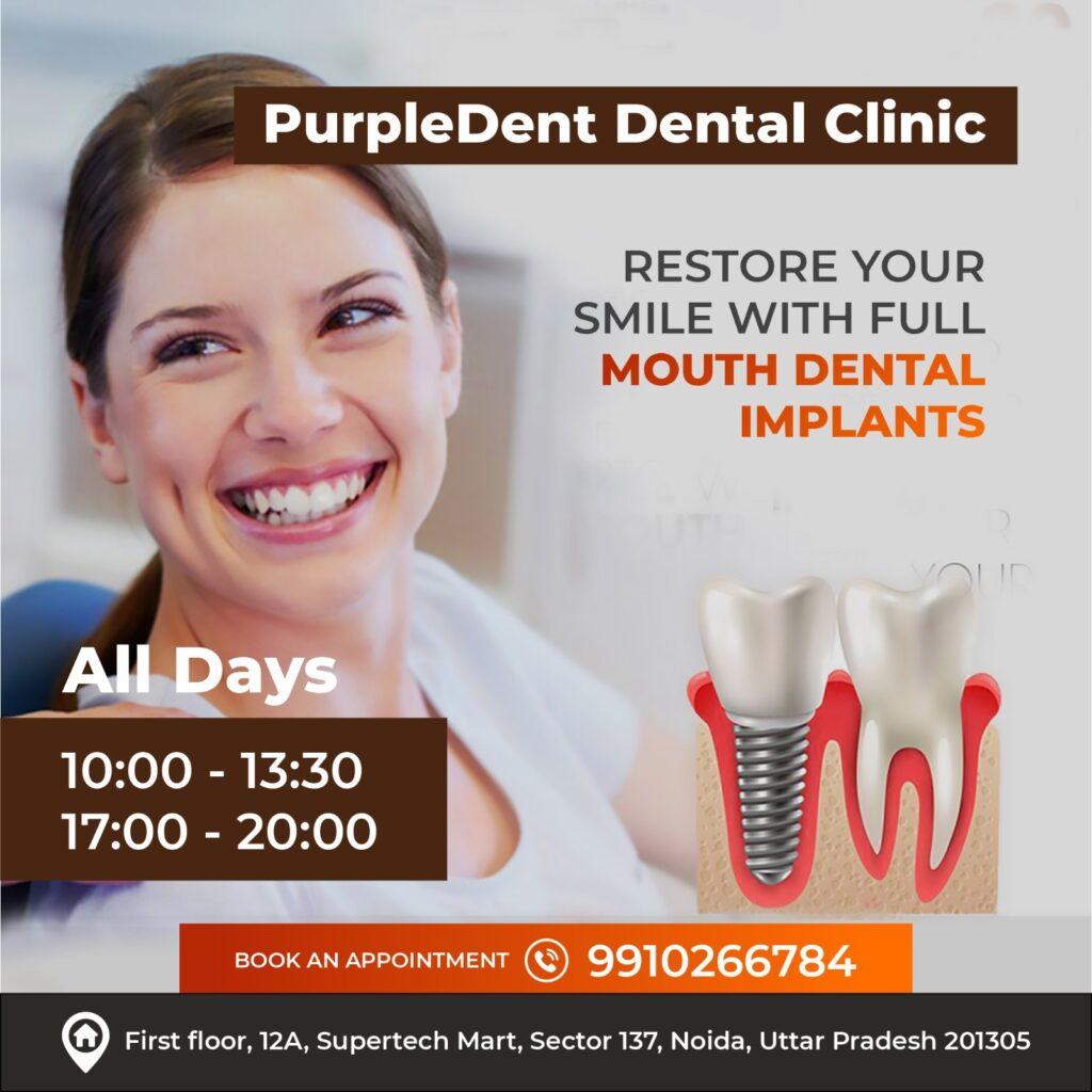 Dental service in PurpleDent Dental Clinic noida