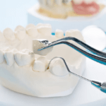 Fit for Royalty: Custom Dental Crown