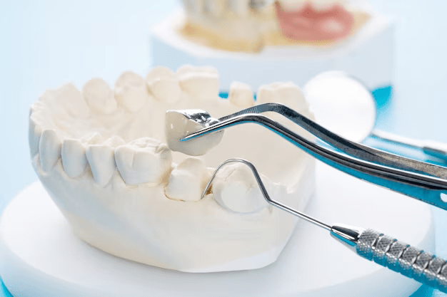 Fit for Royalty: Custom Dental Crown