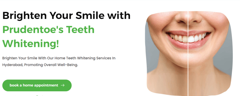 Illuminate Your Smile: Exploring Professional Teeth Whitening Services in Hyderabad with Prudentoe Dental