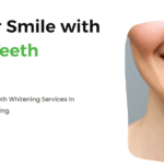 Illuminate Your Smile: Exploring Professional Teeth Whitening Services in Hyderabad with Prudentoe Dental