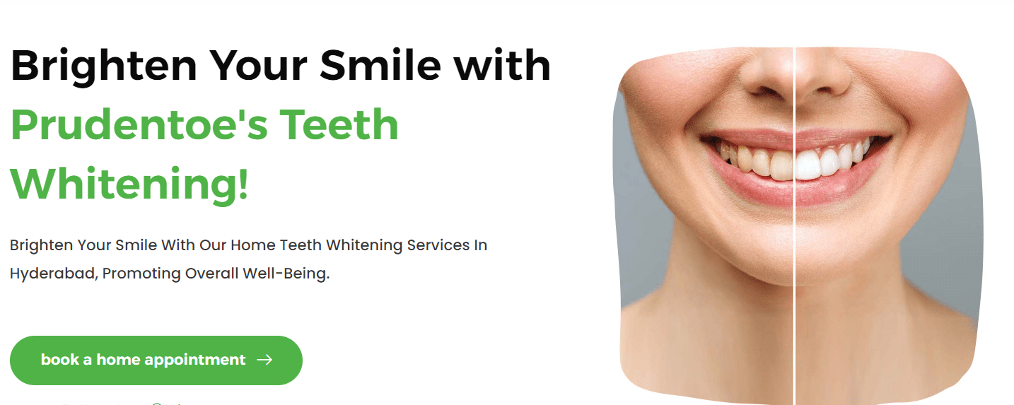 Illuminate Your Smile: Exploring Professional Teeth Whitening Services in Hyderabad with Prudentoe Dental