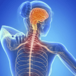 What is multiple sclerosis?