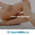 Laser Hair Removal in Toronto: The Ultimate Guide