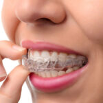 What Can and Can Not Be Treated With Invisalign Aligners?