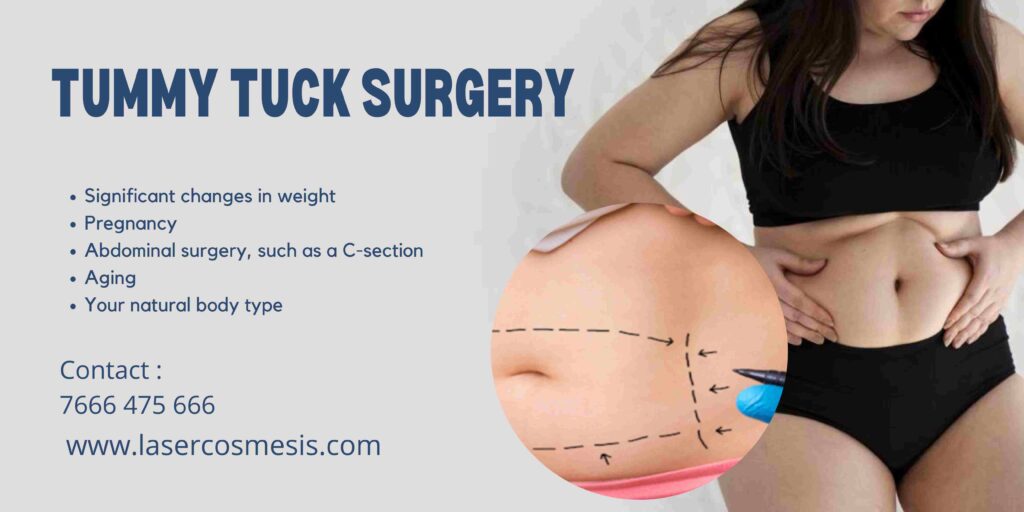 Benefits of a Tummy Tuck After a C-Section