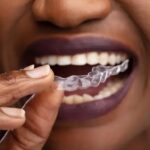 All You Need to Know About Removable Retainers: Types, Uses, and Pros & Cons