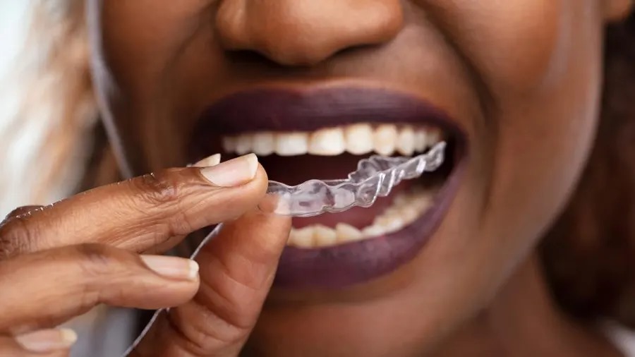 All You Need to Know About Removable Retainers: Types, Uses, and Pros & Cons